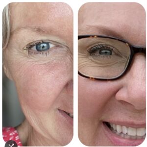 I look younger now than I did 4 years ago!